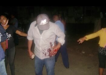 FRANCO HERNÁNDEZ: ¿PARA ESTO QUIEREN LAS PISTOLAS TASER?