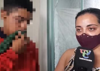 Embarcación | Le desfiguró la boca con una golpiza en la escuela. Enterate qué dijeron desde el establecimiento.